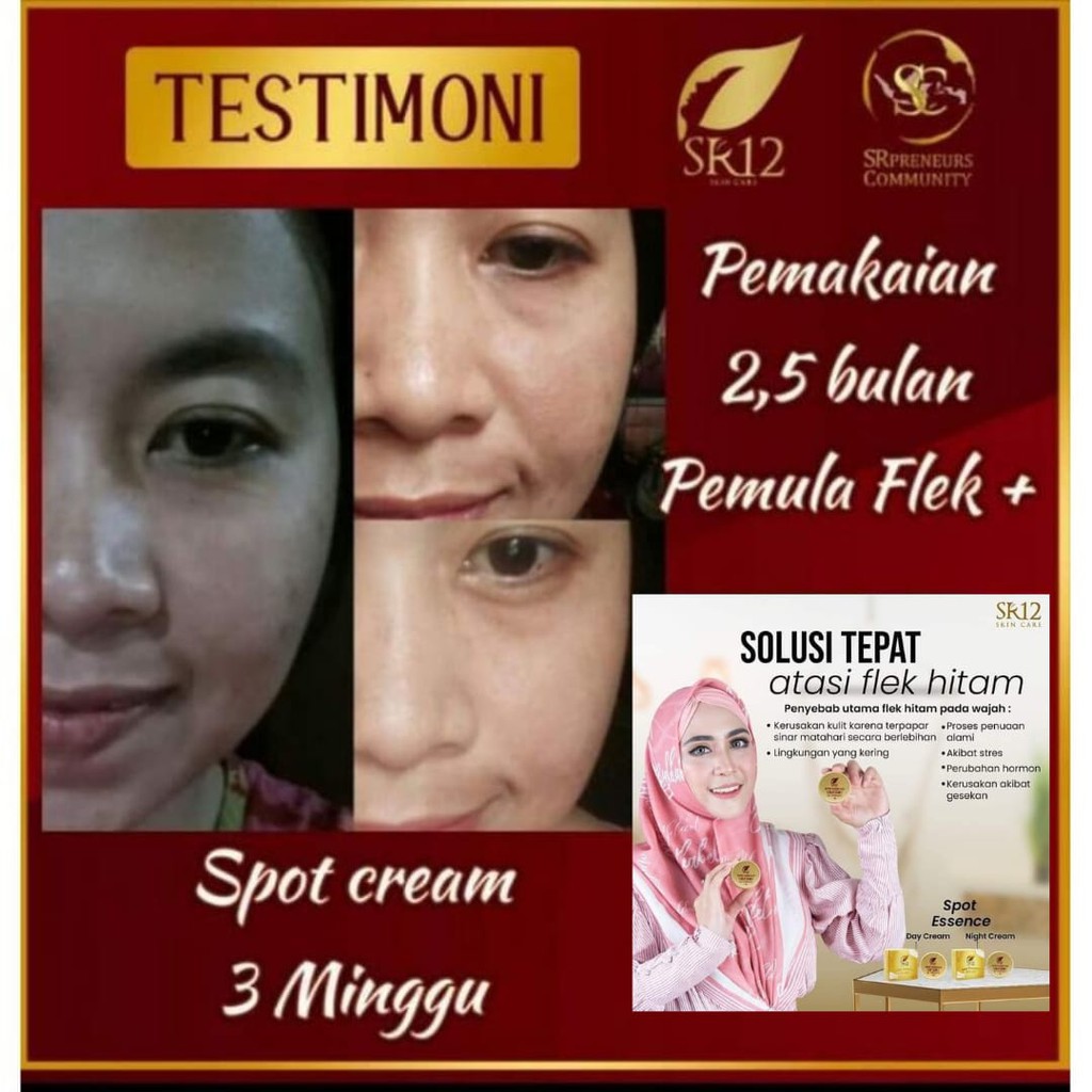 SPOT ESSENCE DAY &amp; NIGHT CREAM SR12 / MENCERAHKAN BEBAS FLEK HITAM BEKAS JERAWAT / CREAM WAJAH