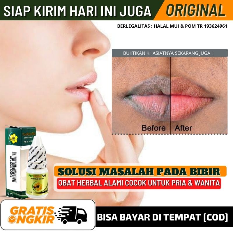 Obat Oles Penghilang Bibir Hitam Karena Rokok, Obat Atasi Gatal Iritasi di Bibir, Obat Alami Bentol 