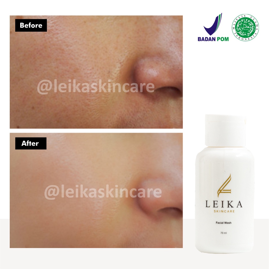 Facial Wash / Sabun Pembersih Pori pori untuk Kulit Wajah Asli 100% Halal Pembersih Wajah Mengecilkan Pori pori Ampuh BPOM Sabun Pengecil Pori pori Facial Wash Leika Skincare - 70ml Resmi BPOM Halal