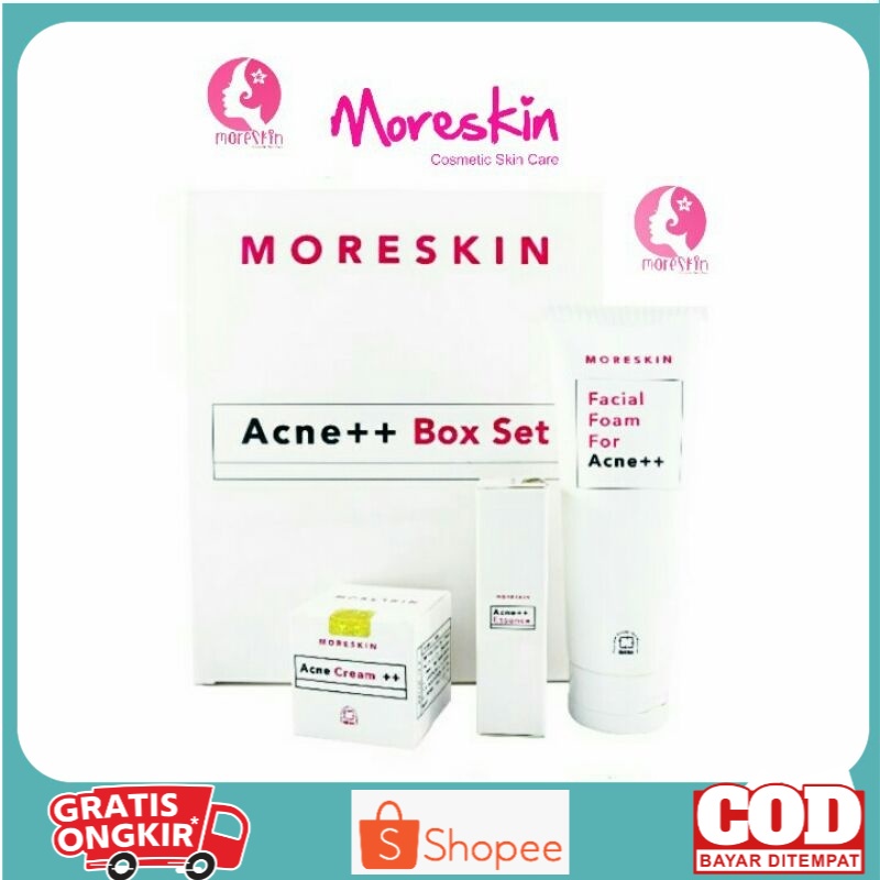 [BIG SALE] Moreskin Acne ++ Box Set - Paket Penghilang Jerawat - Anti Acne - Original Moreskin
