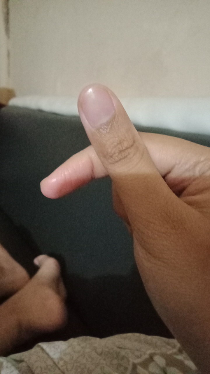 Maker Duckbill Garis //  Chasa & Onecare Readystock