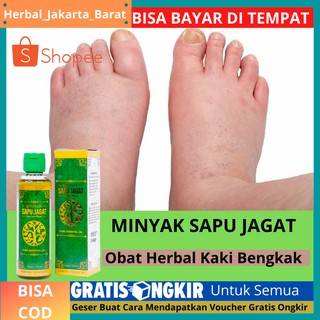 Obat Tradisional Untuk Bengkak Akibat Kesleo : Sicie Oil ...