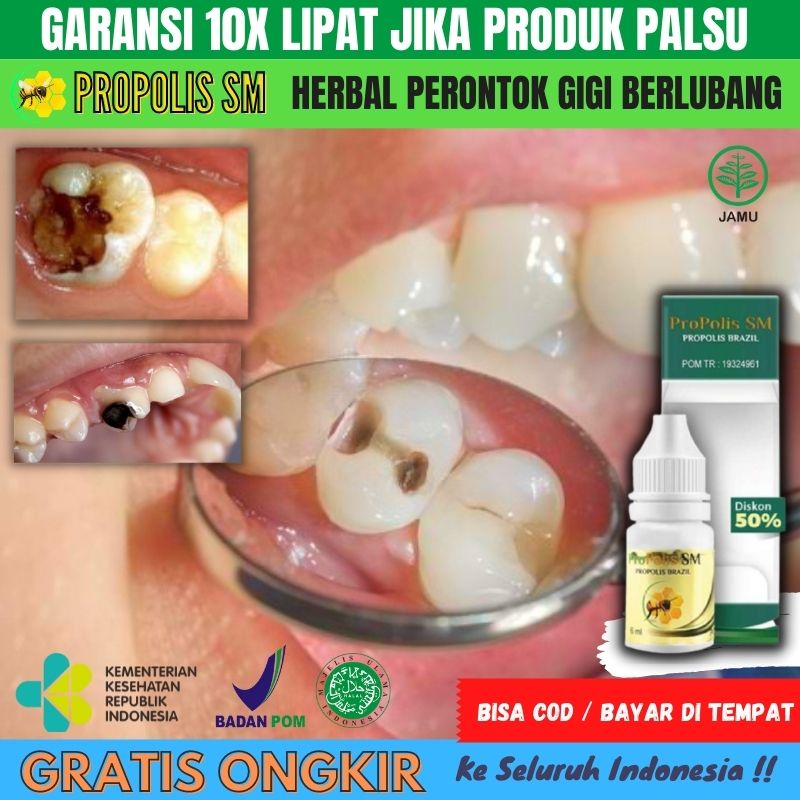 Obat Tetes Perontok Gigi Berlubang Bolong Parah, Obat Sakit Gigi Berlubang, Obat Agar Gigi Berlubang