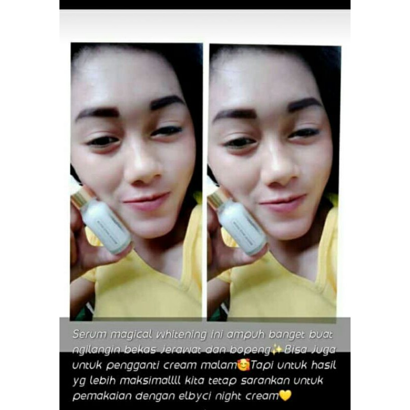 elbyci