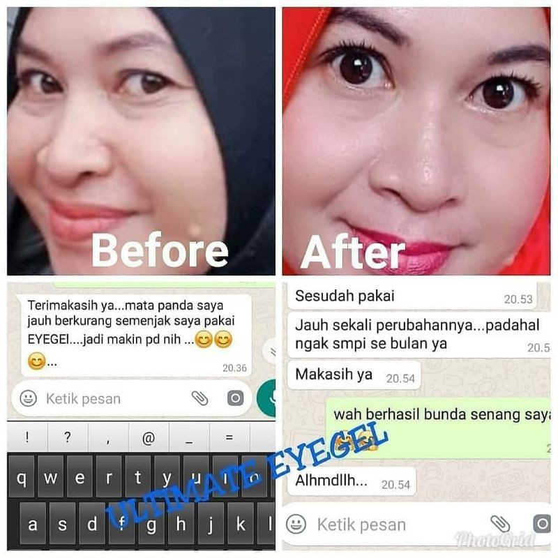 Nebi Ultimate Eye Gel, Cara Mudah Menyamarkan Kantung Mata, Mata Panda &amp; Keriput Untuk Wanita &amp; Pria.