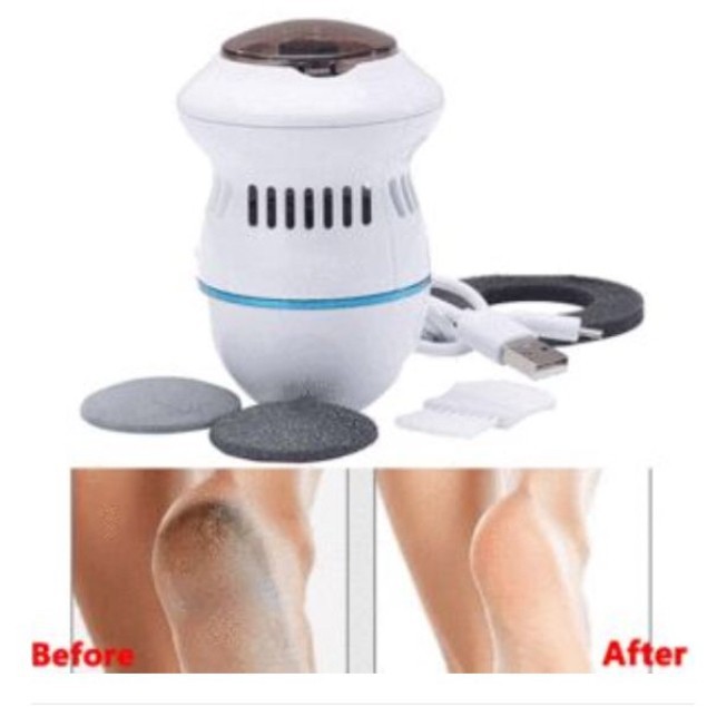 Alat penghalus tumit / electric foot grinder untuk tumit kasar