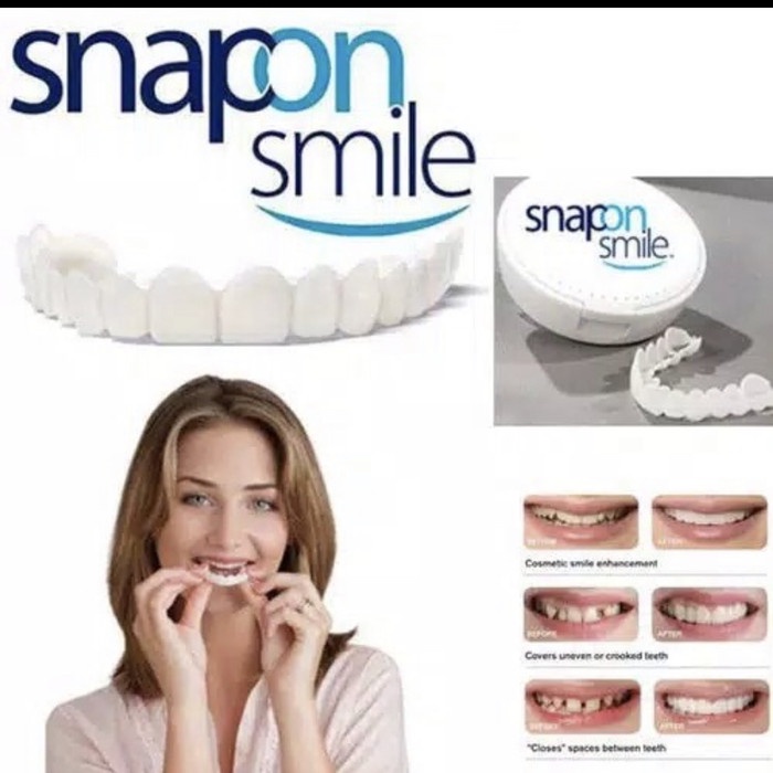 Snap On Smile 100% Original Authentic / Snap 'N Smile Gigi Palsu Terlaris