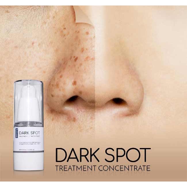 [ORI] Serum Pencerah Wajah Ampuh Menghilangkan Flek Dark Spot Treatment Concentrate dalam 2 Minggu