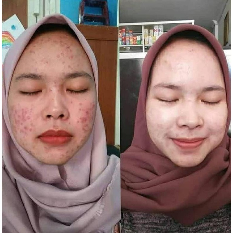SABUN BIBIT PEMUTIH BADAN PERMANEN SABUN BATANG 50GR BPOM SABUN BIBIT ORIGINAL