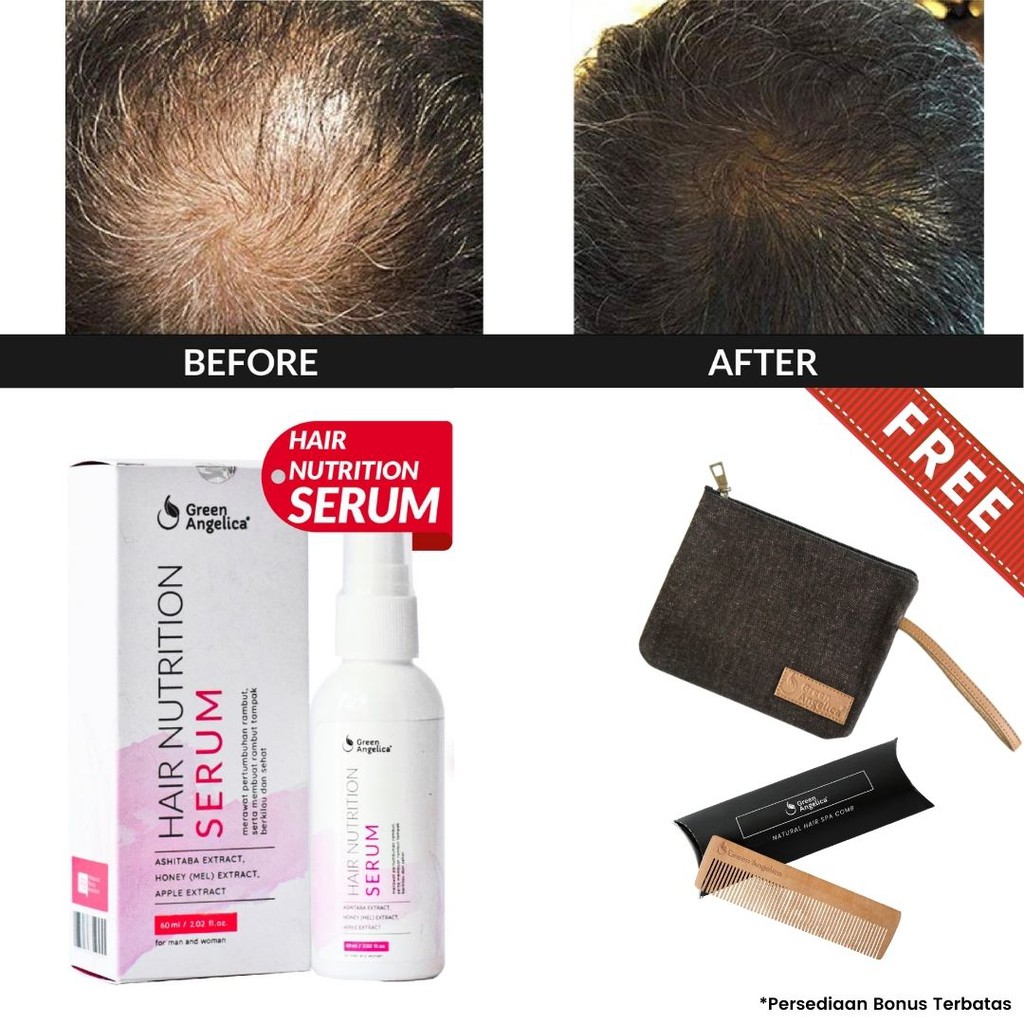 Green Angelica Hair Serum Rambut Rontok Serum Vitamin Green Angelica Hair Serum Rambut Rontok Serum Vitamin