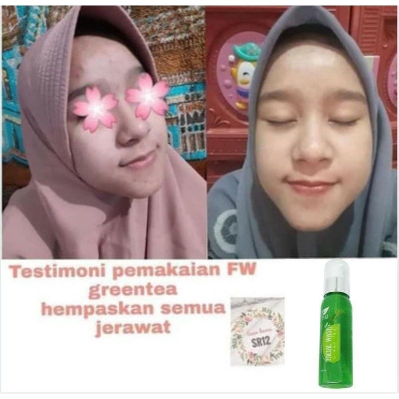 FACIAL WASH GREEN TEA SR12 / SABUN WAJAH GREEN TEA SR12 BPOM / MENCERAHKAN WAJAH / FACIAL WASH GREENTEA / SABUN SEMUA JENIS KULIT