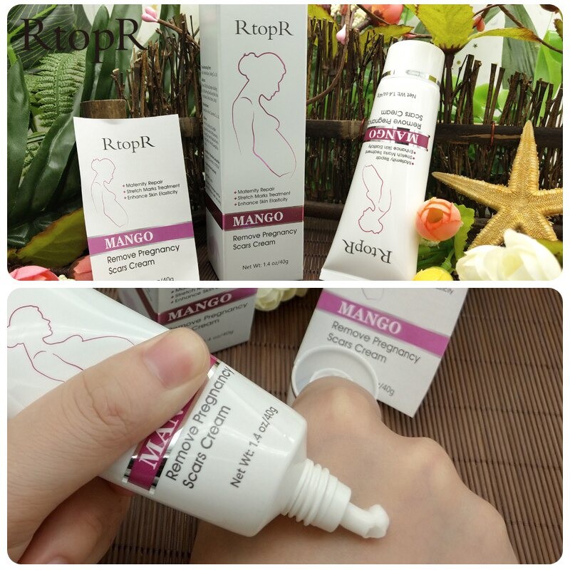 [Terbukti Alami] Rtopr Cream Penghilang Stretch Mark Bekas Luka Kerutan Tubuh Perut Ibu Hamil
