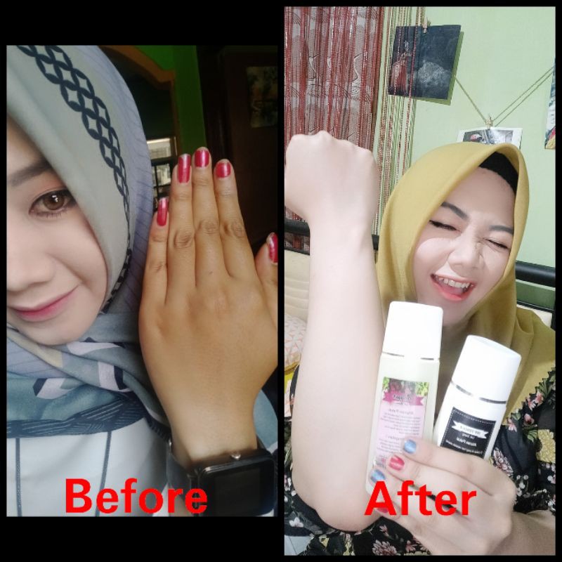 ORIGINAL LOTION MALAM DOSIS TINGGI