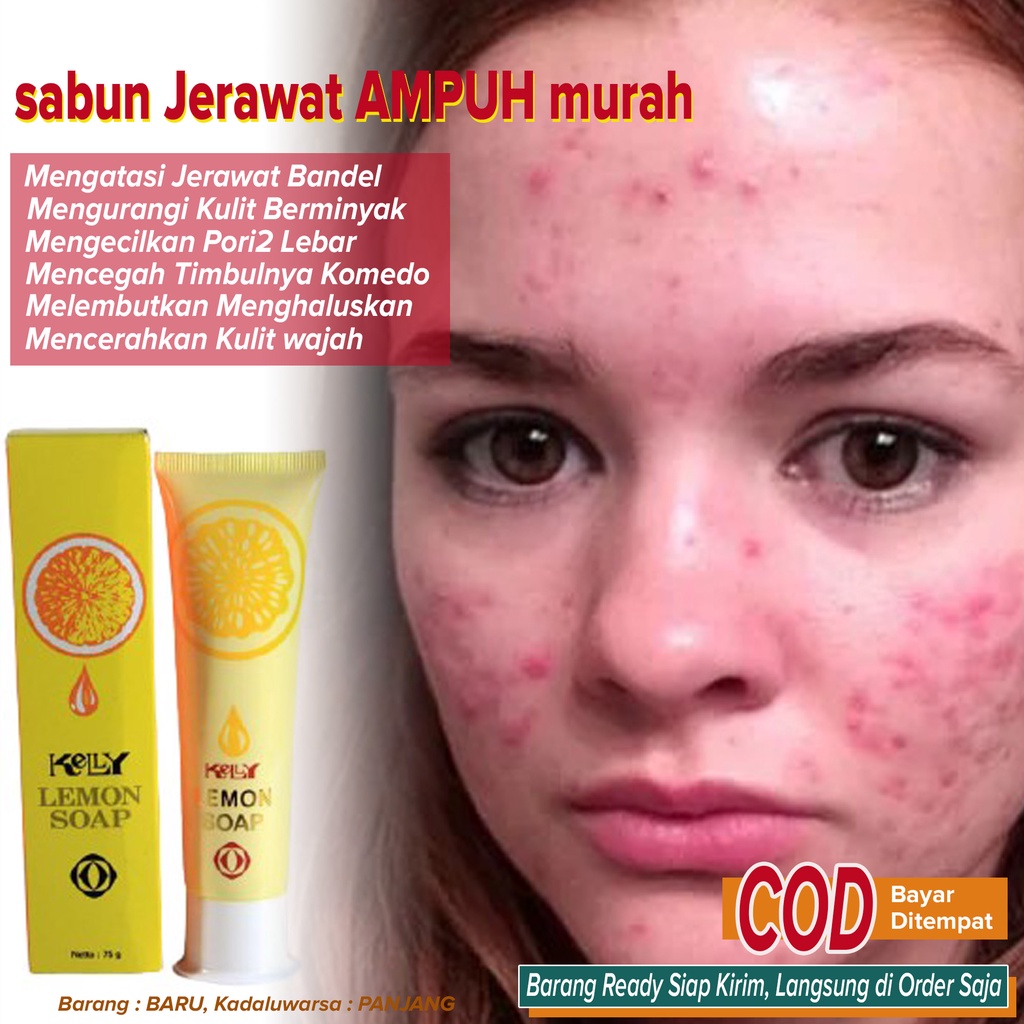 Sabun Jerawat Sabun Pembersih Jerawat anti Acne AMPUH Murah ~ Kelly Lemon Soap 25gr