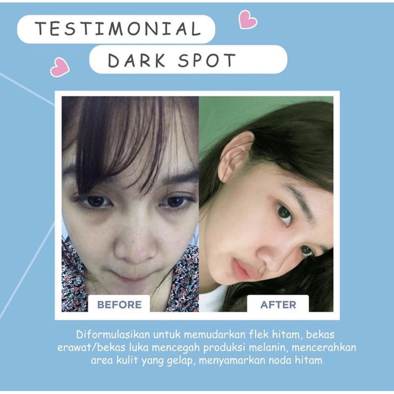 DARK SPOT TREATMENT MSGLOW