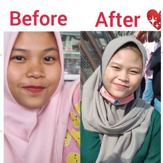 Daviena skincare medan - Glowing series Komplit / Paket Hemat Daviena Best seller-3