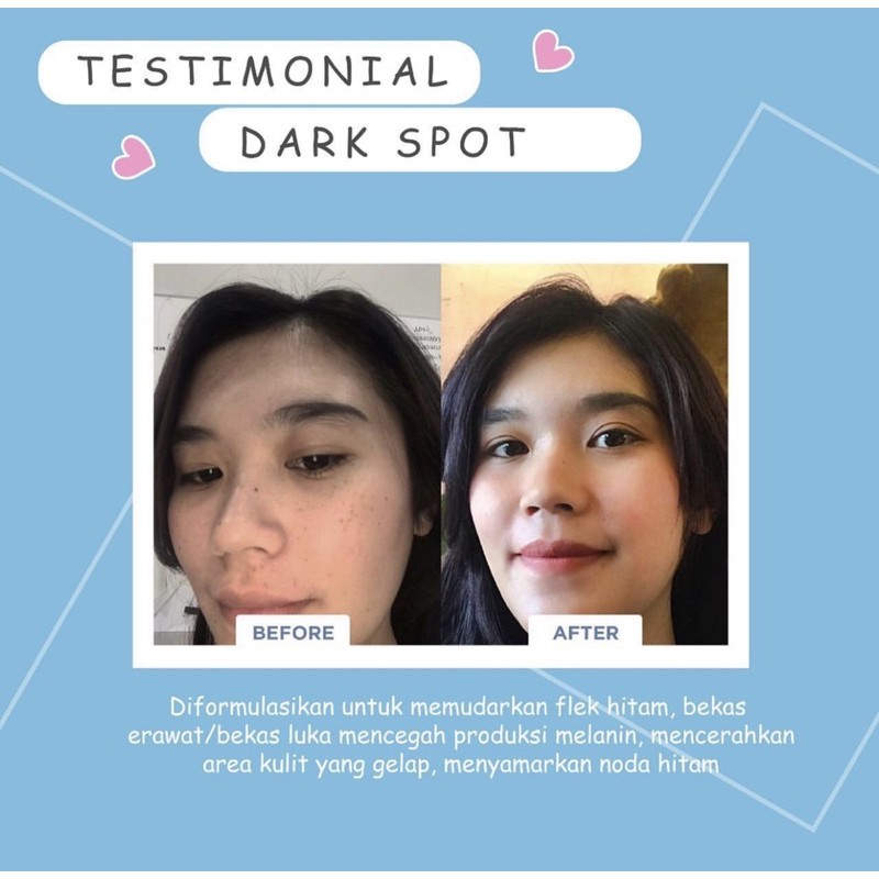 DARK SPOT TREATMENT MSGLOW