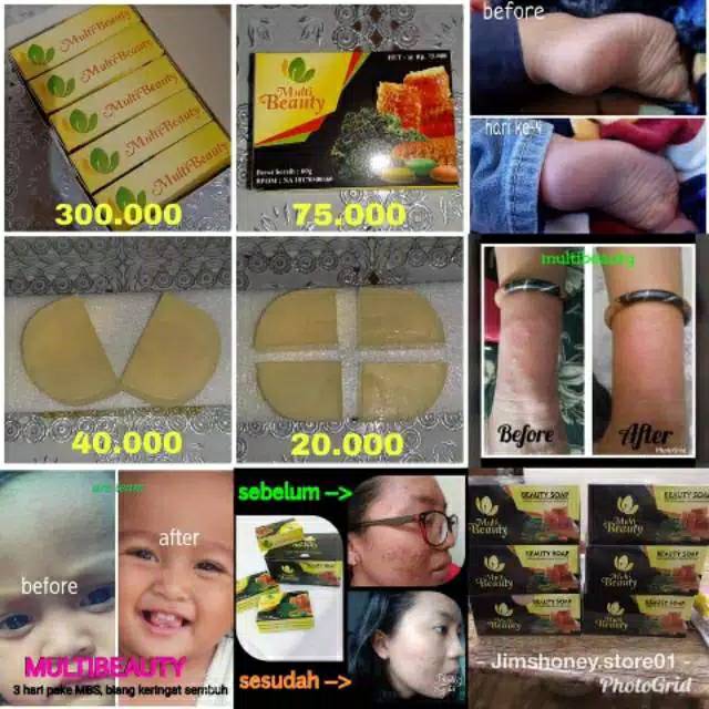PROMO FREE JARING MultiBeauty Soap ORI || Sabun Kecantikan dan kesehatan