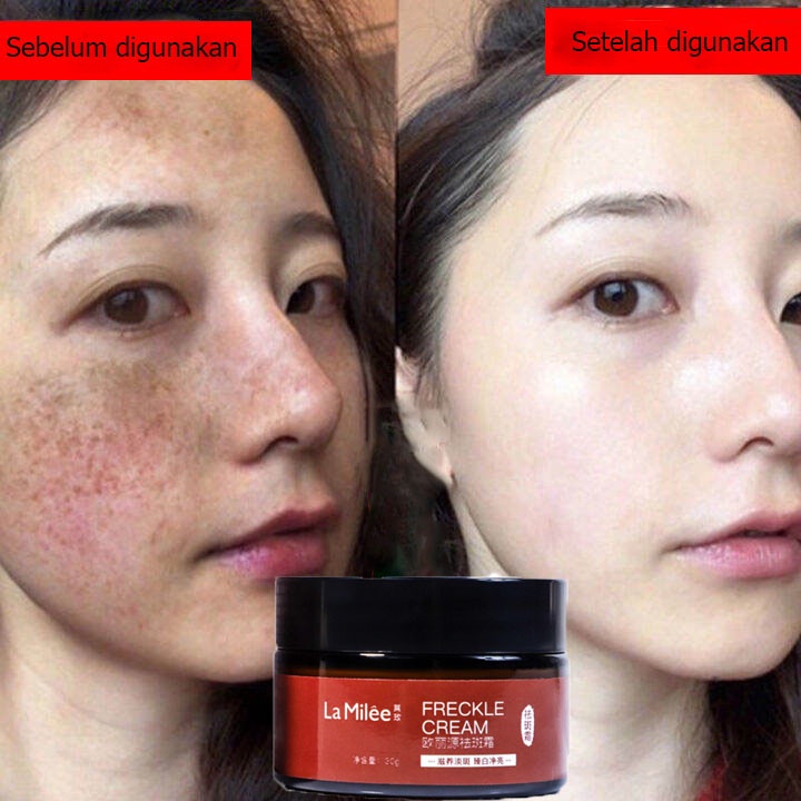 krim penghilang melasma Krim Pemutih Wajah Krim Penghilang Bintik Hitam 30g meringankan melasma dan bintik-bintik Mencerahkan kulit Mengurangi kulit kusam