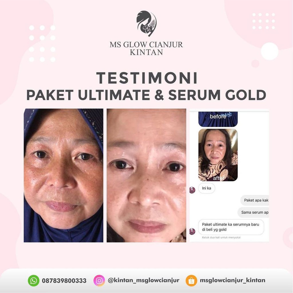MS Glow Paket Ultimate Original Perawatan Wajah Glowing Menyamarkan Kerutan & Keriput BPOM Bisa COD-4