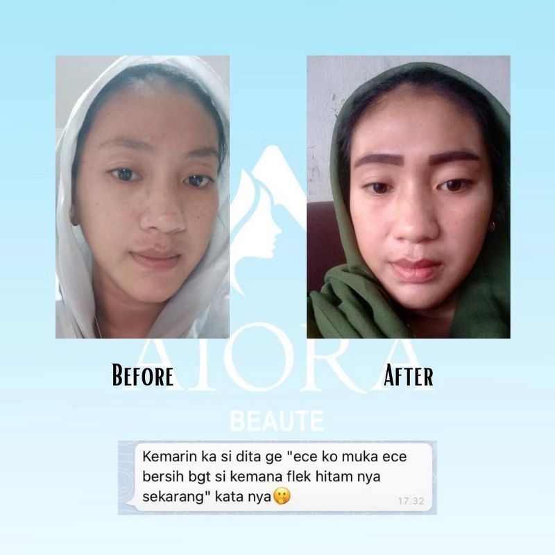 AIORA SKINCARE BPOM CREAM WAJAH PAKET GLOWING ACNE-8
