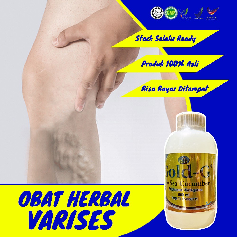 REAKSI CEPAT Obat Herbal Ampuh Penghilang Varises di Kaki dan Betis, Panggul, Anus, Vagina, Rahim 10