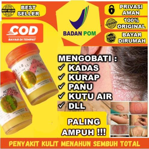 𝗦𝗔𝗟𝗘𝗣 𝗭𝗪𝗔𝗙𝗘𝗟 𝗜𝗧𝗖𝗛𝗬 𝟮𝟰 𝟮𝟯𝟰 Belerang Sulfur 100% Original BPOM Salep Gatal Kutu Air Eksim Panu Kurap Biduran Gudik Scabies