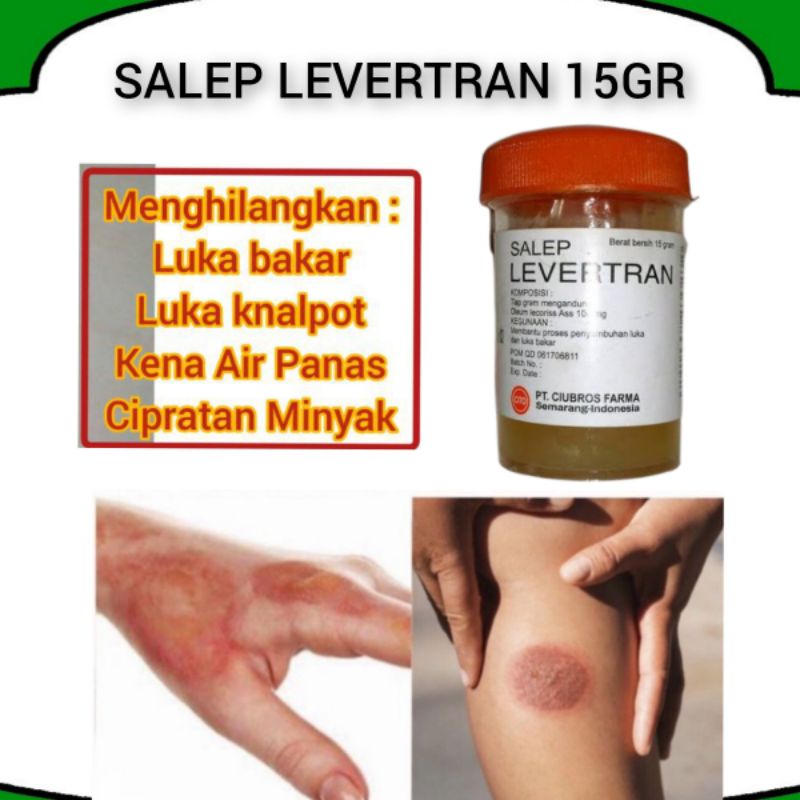 SALEP LEVERTRAN 15GR I SALEP LUKA BAKAR I OBAT LUKA KULIT