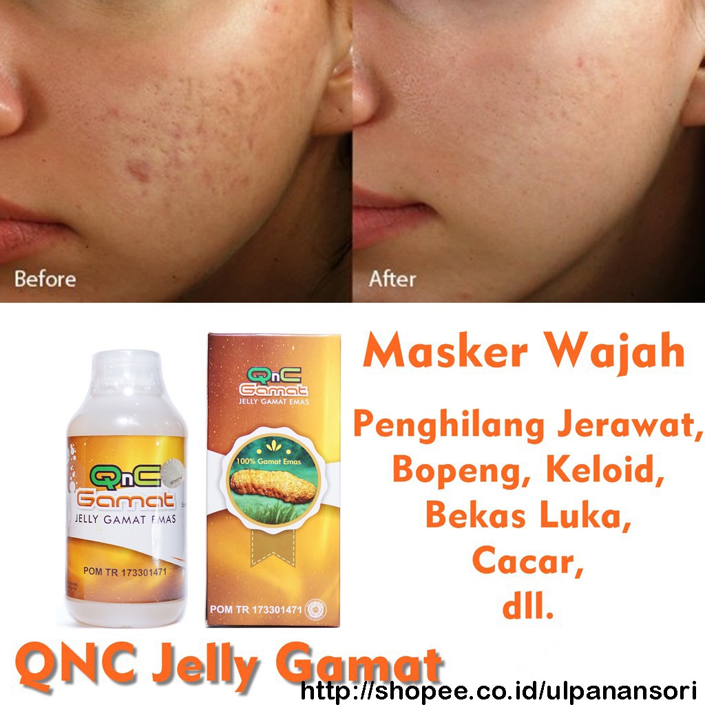 Khasiat Dan Manfaat Qnc Jelly Gamat Untuk Kecantikan Masker Teripang Emas Alami Indonesia