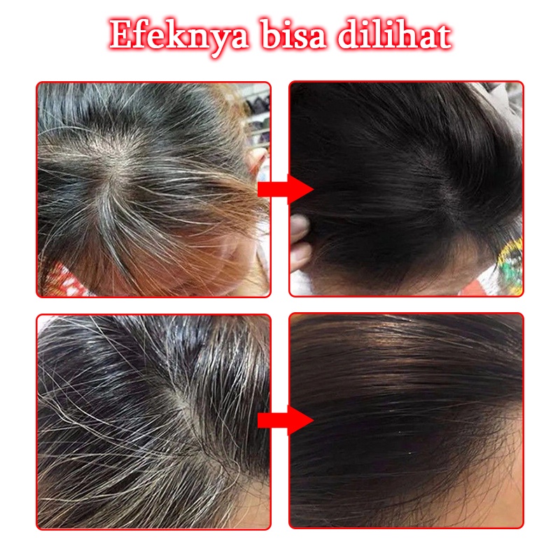 Hitam spray Hair growth serum spray Anti tonik rambut rontok Pertumbuhan rambut cepat 100ml Rambut putih tercepat di Indonesia menjadi rambut hitam Ekstrak tumbuhan alami Rambut hitam permanen