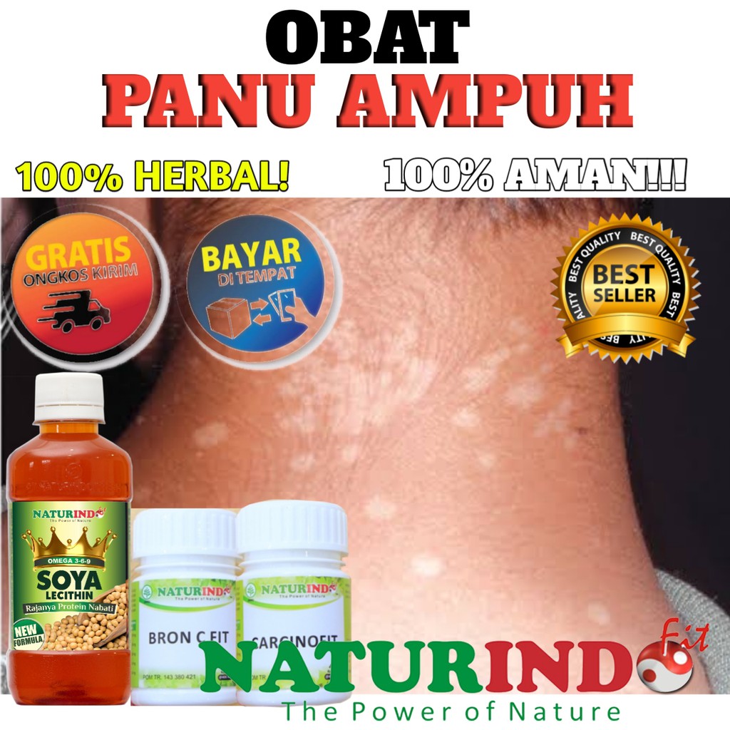 Obat panu menahun ampuh herbal naturindo alergi kulit gatal kadas kudis kurap koreng COD BPOM