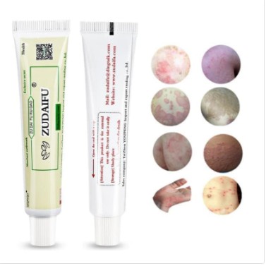 Obat Salep Gatal Gatel Kulit Kurap Jamur Bakteri Zudaifu Herbal-1