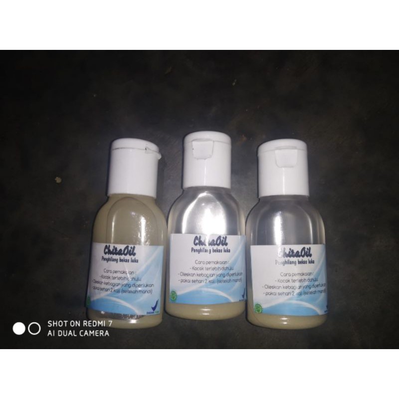 [BISA COD]CHITA OIL PENGHILANG BEKAS LUKA, KORENG, EXCIM, DLL [TIPE BASAH]