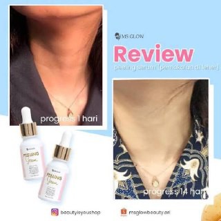 [LOCAL]MS GLOW SERUM LUMINOUS GLOWING SERUM LIFTING SERUM ACNE SERUM GOLDII 15ml
