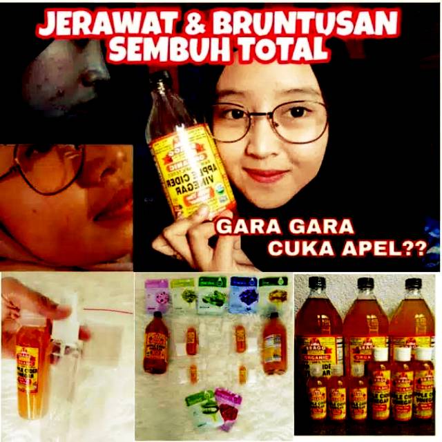 

Cuka apel Murni 100 ml Flip Top