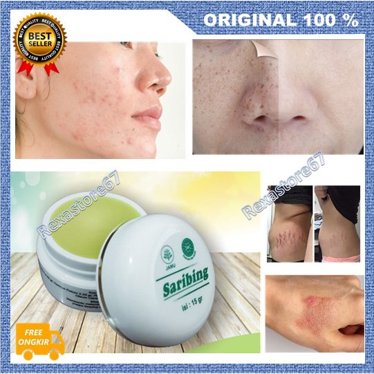 [BISA COD] PROMO Cream Saribing Bokashi Cream Flek Hitam Obat Penghilang Bekas Luka Bekas Jerawat