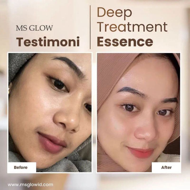 Deep Treatment Essence with Salmon DNA