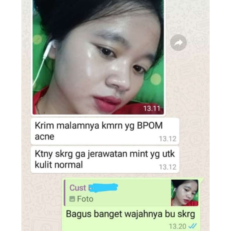 paket acne care inusa