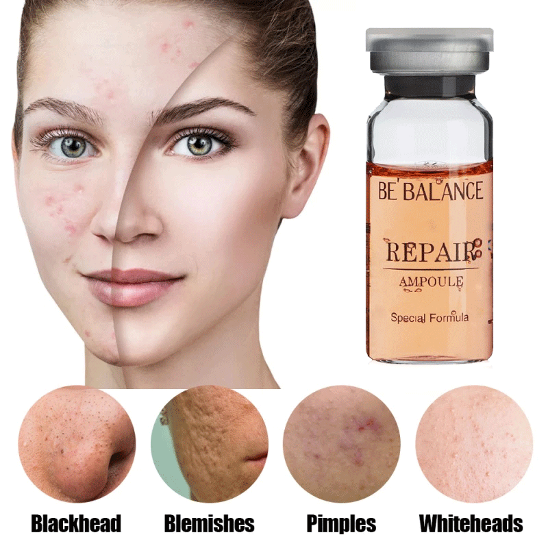 BE BALANCE Serum Wajah REPAIR Serum MTS REPAIR /ALA / BRIGHTENING /HYDRO