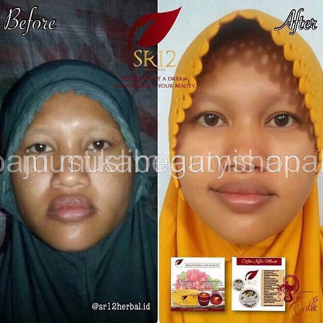 CREAM PENCERAH BRIGHTENING Cream SR12 / KRIM SPF SR 12 BPOM