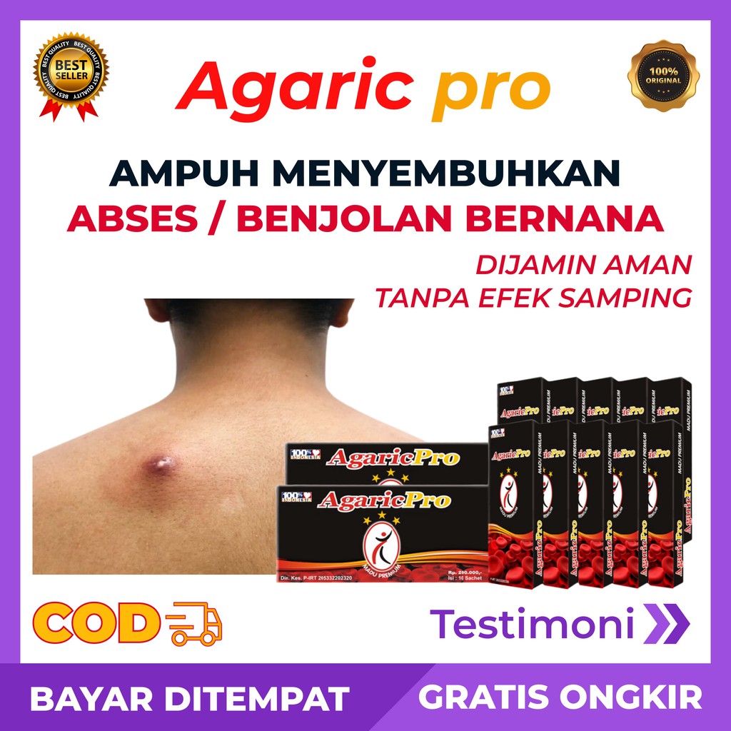 AGARICPRO-ORIGINAL-AMPUH-ATASI-ABSES-BENJOLAN-BERNANA-ASAM-URAT-ORIGINAL
