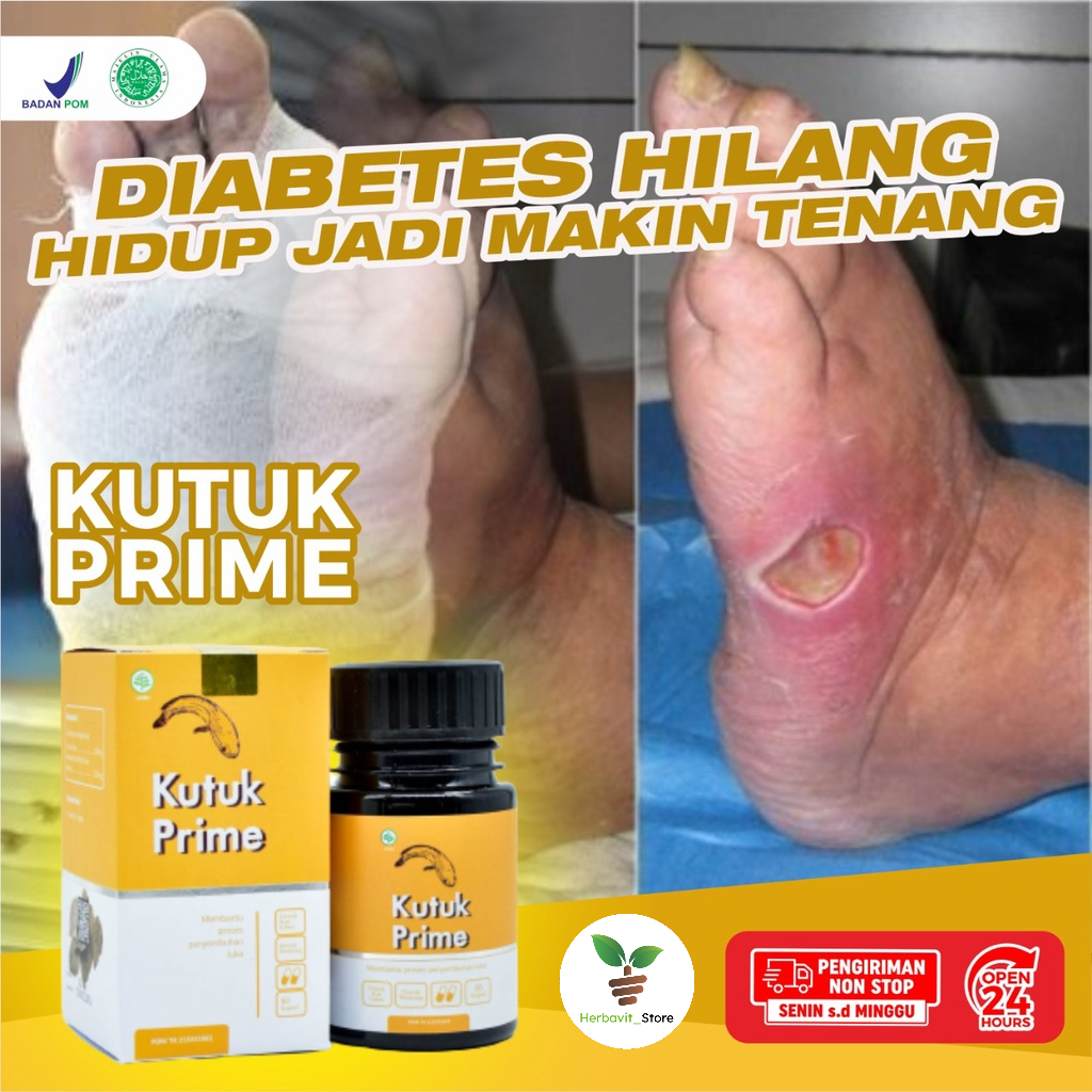 [COD] Kutuk Prime – Kutuk Kapsul Kutuk Prime 100% Ekstrak Ikan Gabus Atasi Luka Operasi Sembuhkan Diabetes Cepat Keringkan Luka Operasi Turunkan Kadar Gula Cegah Infeksi Pada Luka Cegah Keloid Atasi Luka Bakar Kecelakaan