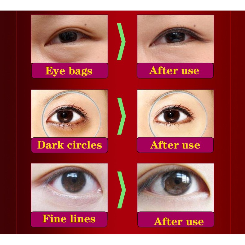 Eye Cream Eye Serum 20g Meringankan Lingkaran Hitam/Kerutan Mata/Pelembab Mencerahkan/Mengencangkan Area Mata