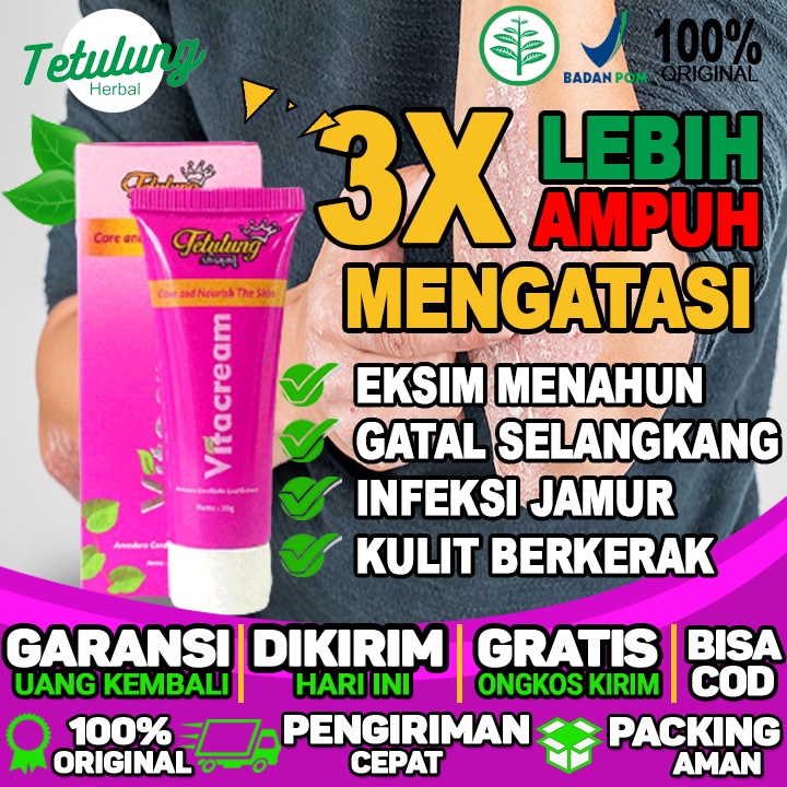 Obat Gatal Jamur Eksim Obat Jamur Eksim Obat Eksim Kering Alami Obat Eksim Kering Menahun Di Kaki Ob