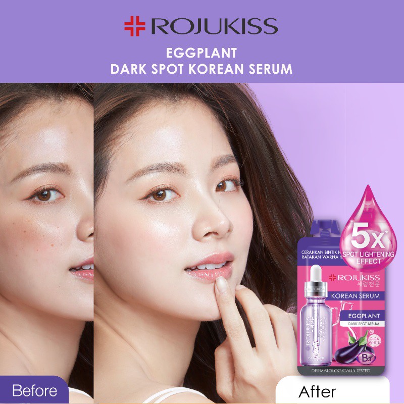 [BPOM] Rojukiss Korean Serum 8 ml [EGGPLANT | Orange C+ |Tea Tree | Jeju Lotus]