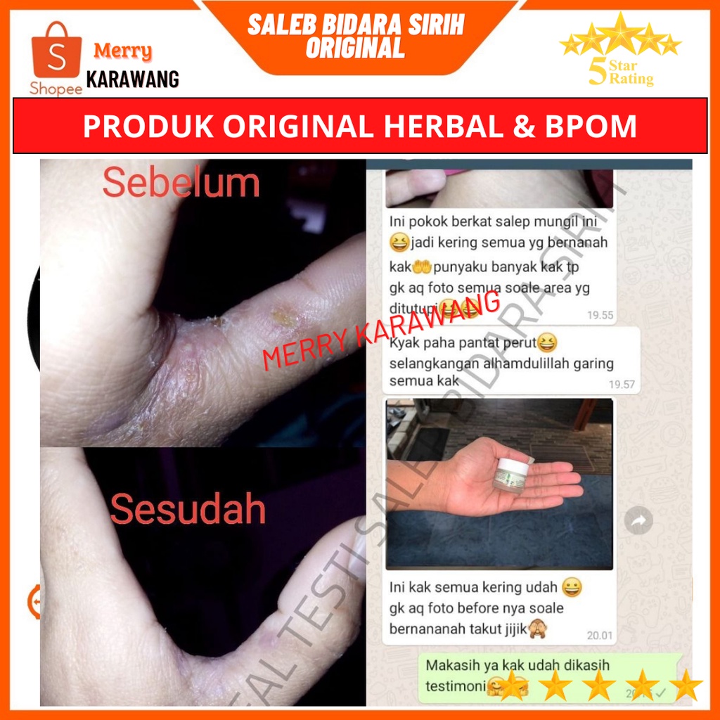 Salep Bidara sirih original Salep Gatal