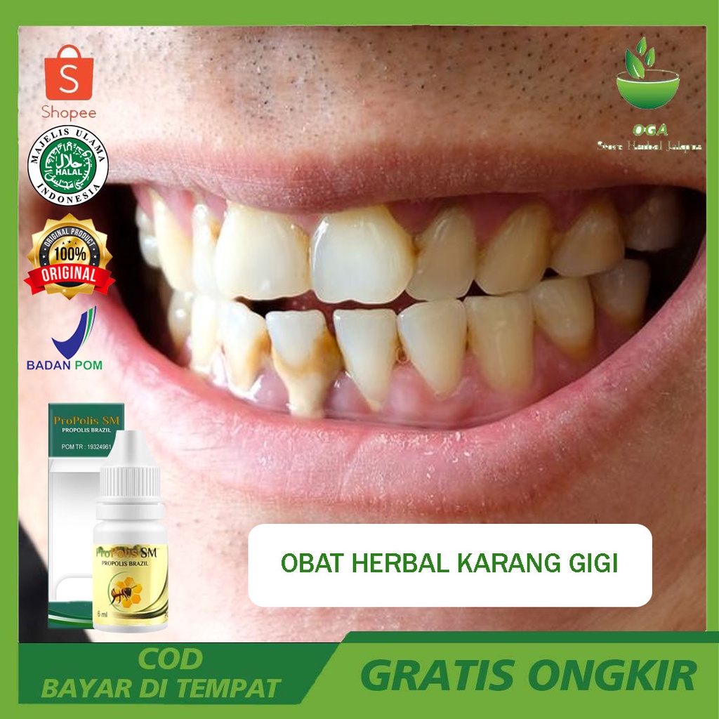 Obat Herbal Karang Gigi Ulat Gigi Anti Karang Gigi Membandel Karang Gigi Dan Plak Obat Kumur Peronto