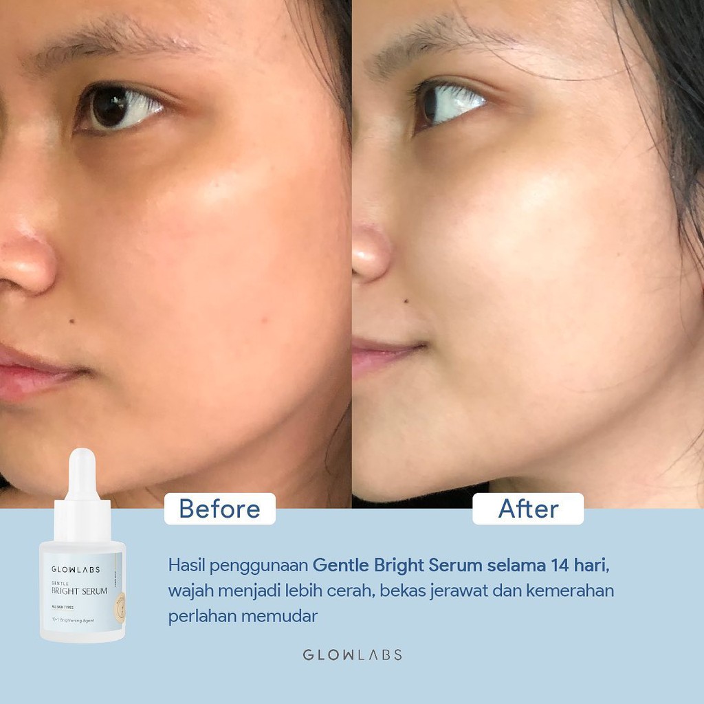 GLOWLABS Gentle Bright Serum 20ml - Serum Mencerahkan Kulit Wajah