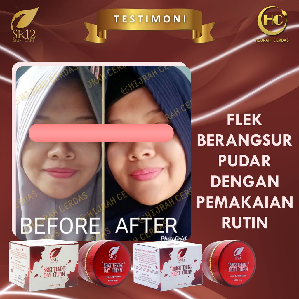 BRIGHTENING CREAM SR12 / CREAM PENCERAH