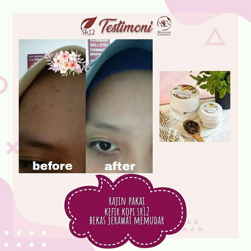 SR12 MASKER KEFIR KOPI BPOM ORIGINAL / COFFEE KEFIR MASK / FLEK HITAM / MEREGENERASI SEL KULIT MATI